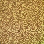 Gros plan sur des cellules observées au microscope, dans un laboratoire de recherche médicale sur l'intestin